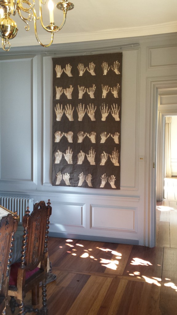 20160823 K Thompson Lepers Hands